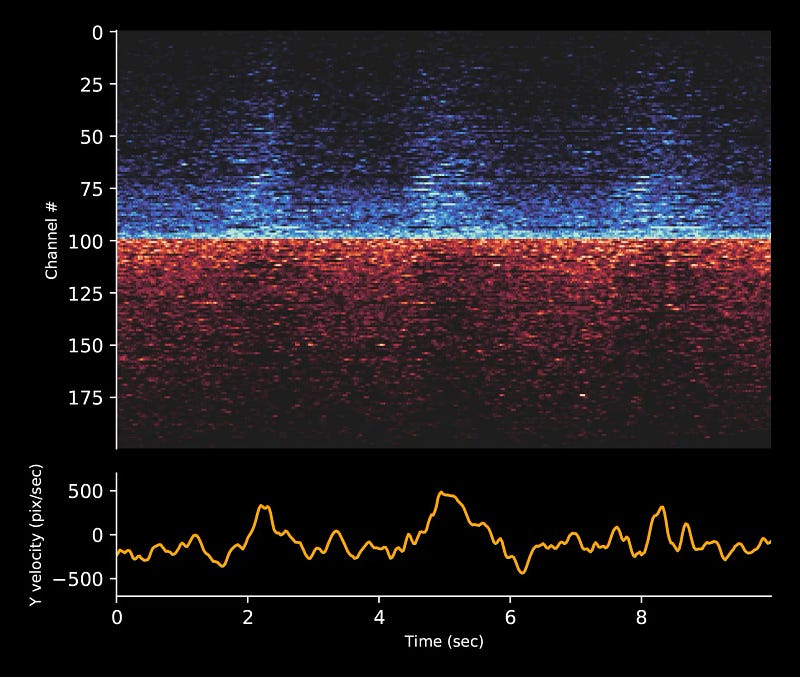 Neuralink in action with Pager